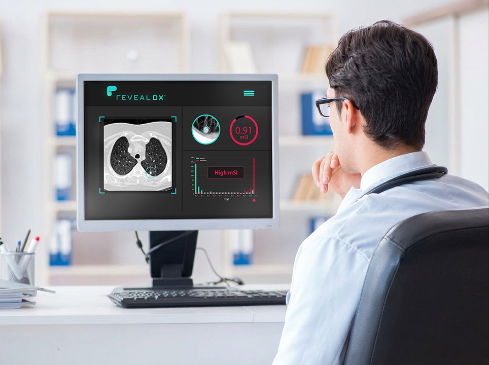 A radiologist reviewing a chest CT with the RevealAI-Lung result panel open in the same viewer.